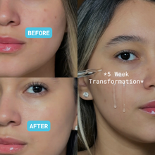 10% Tranexamic Acid Dark Spot Serum - omicskincare