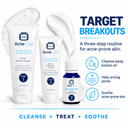3 Step Acne Removal Kit - omicskincare